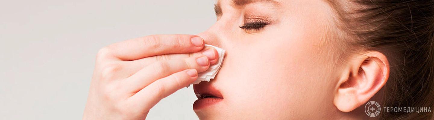 Как остановить носовое кровотечение у ребенка