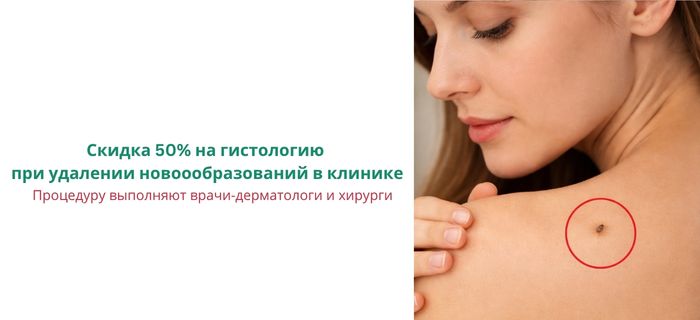 Обложка акции