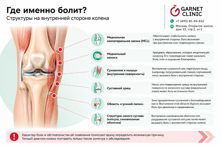 Боль в колене сбоку с внутренней стороны