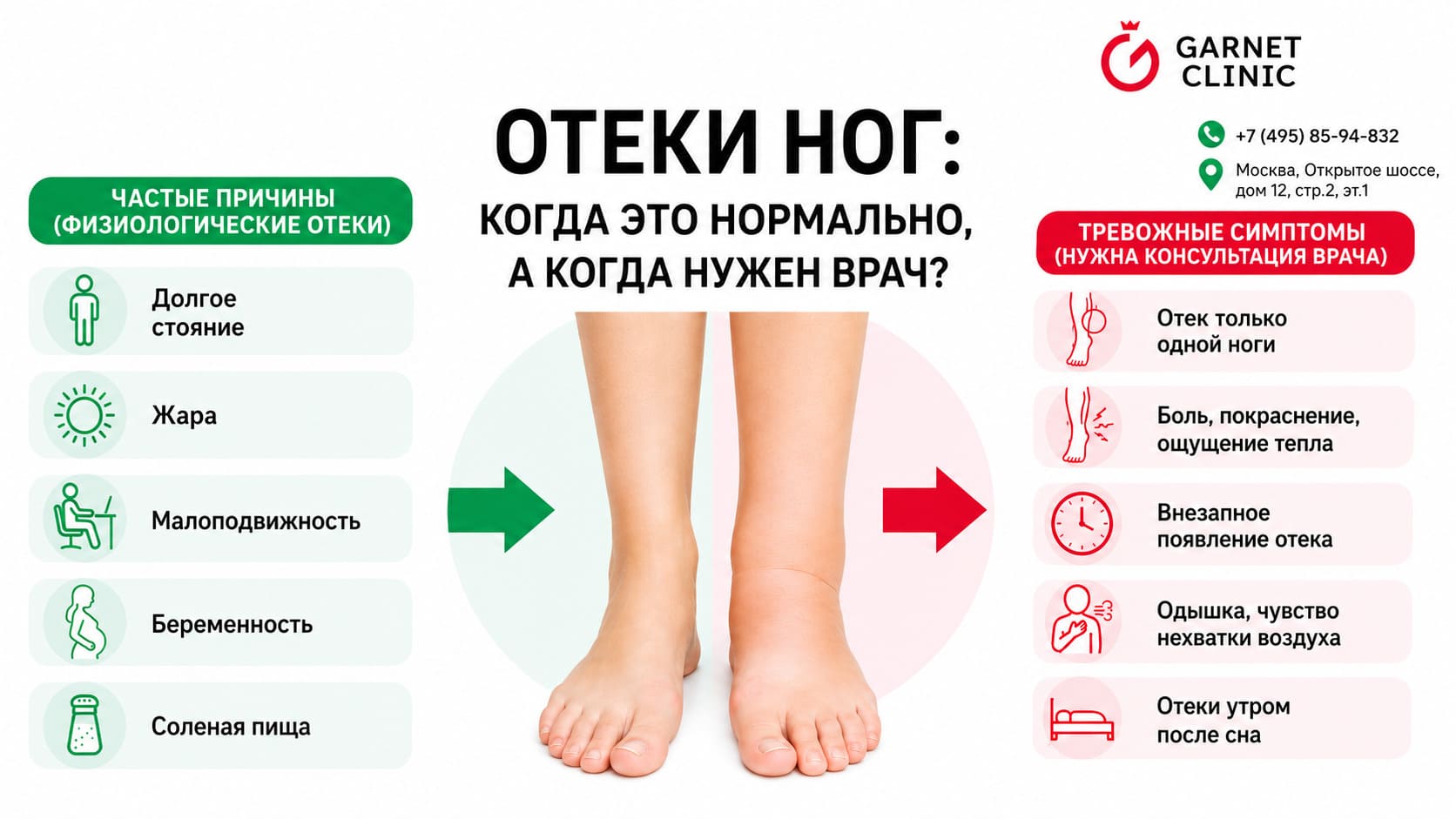 Отеки ног: когда это нормально, а когда нужен врач