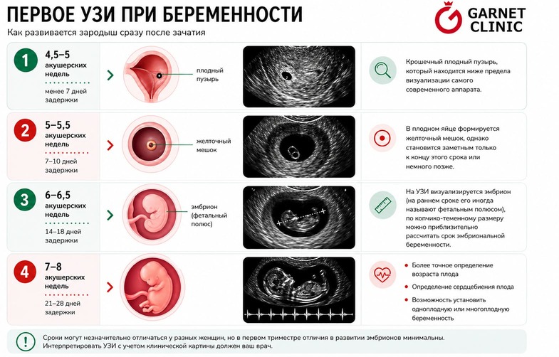 Первое УЗИ при беременности