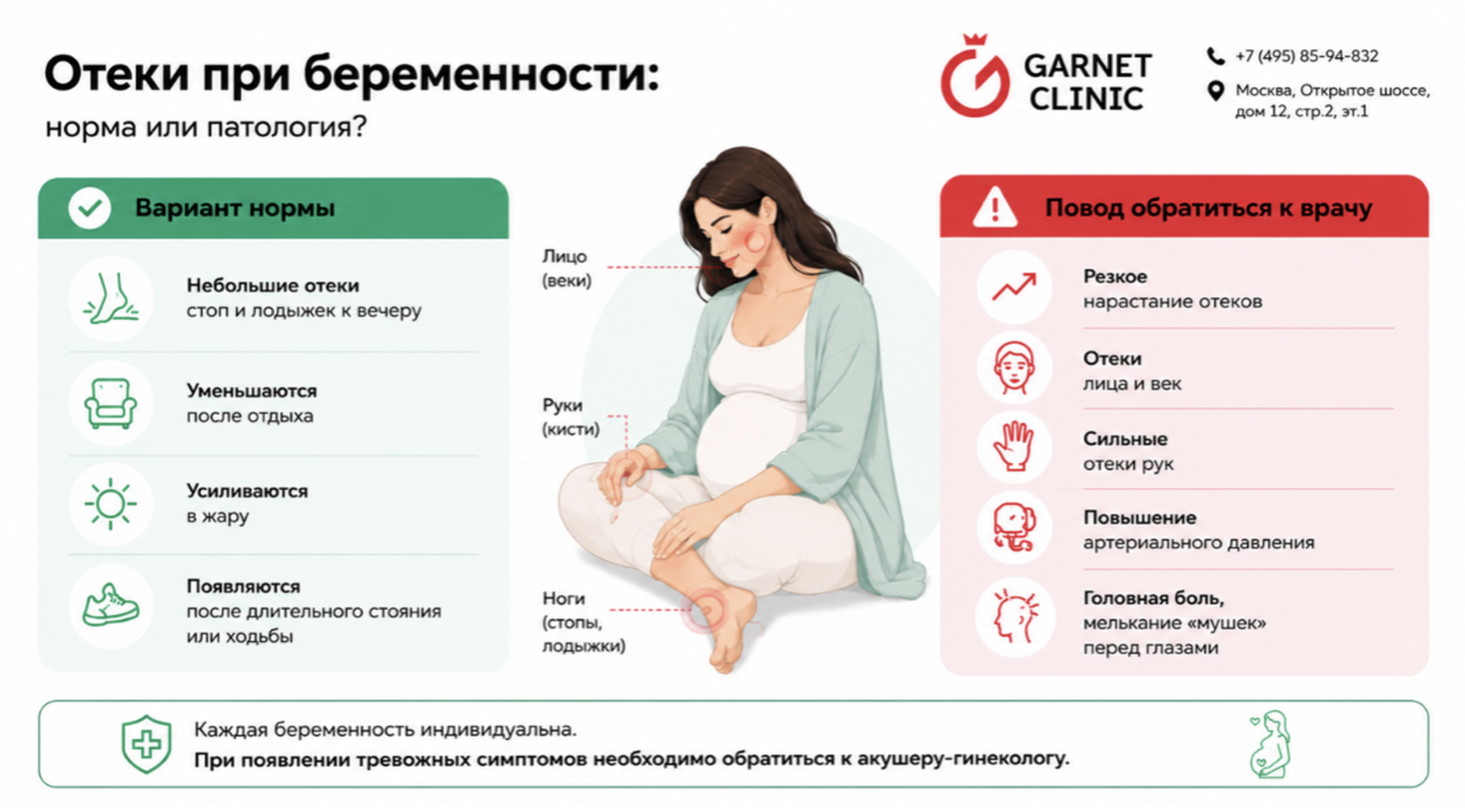 Отеки при беременности: норма или патология?