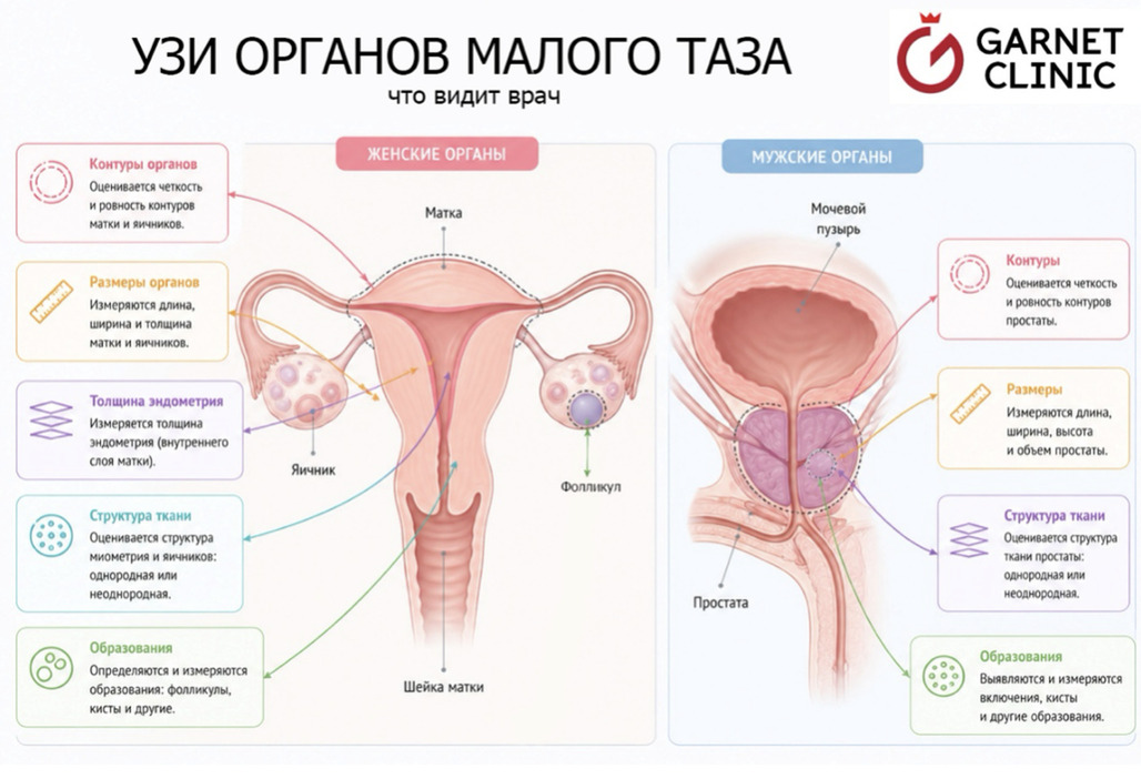 УЗИ органов малого таза