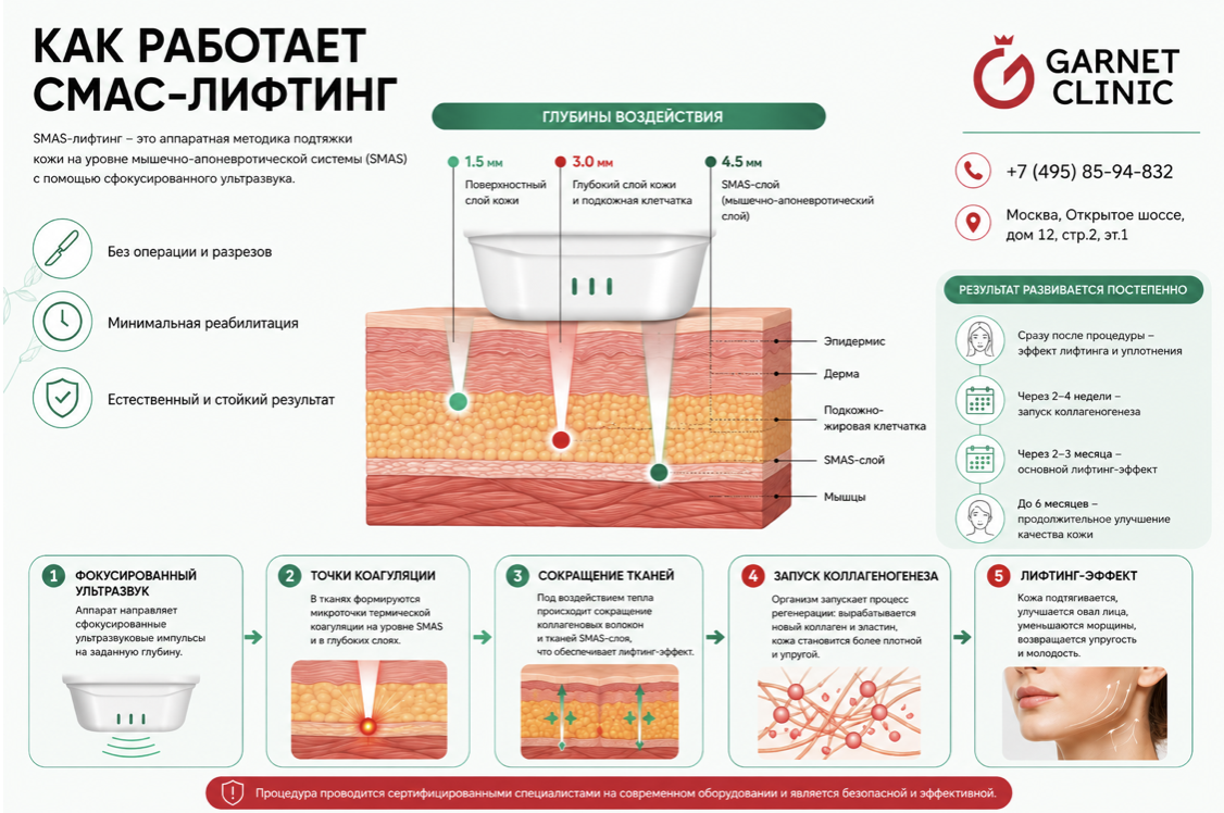 Как работает СМАС-лифтинг
